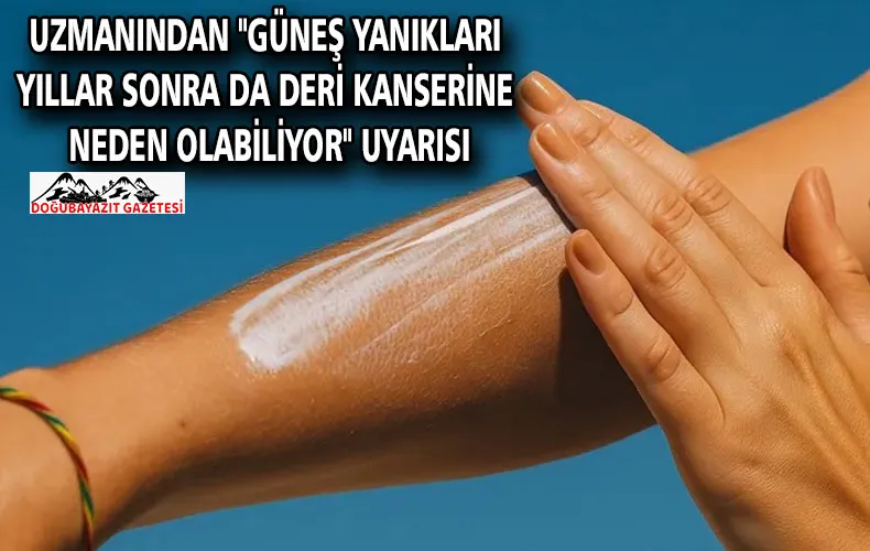 Uzmanından 